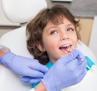 La sigillatura dei denti: cos’è e a cosa serve