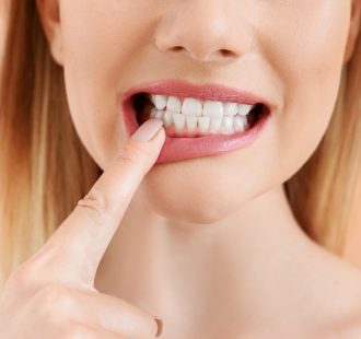 La bocca e i campanelli d’allarme per la celiachia