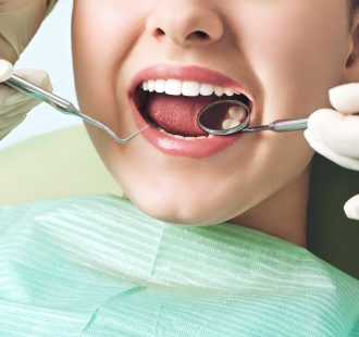 L’otturazione del dente: procedura, materiali e costo