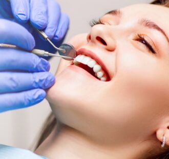 Il sondaggio parodontale: come funziona e perché è importante