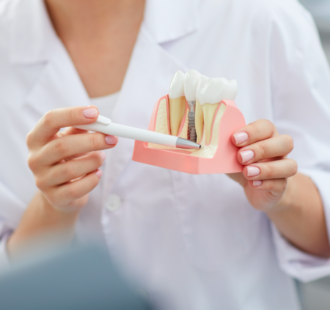 La gestione domiciliare delle riabilitazioni implantari: dalla chirurgia al mantenimento domiciliare