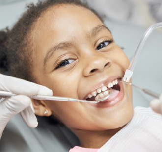 Qual è la causa della fluorosi dentale?