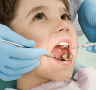 La pulpectomia dei denti decidui